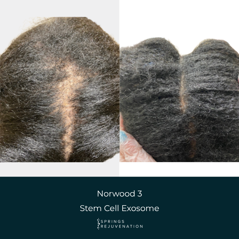 Before and After Results